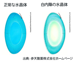 水晶体の比較