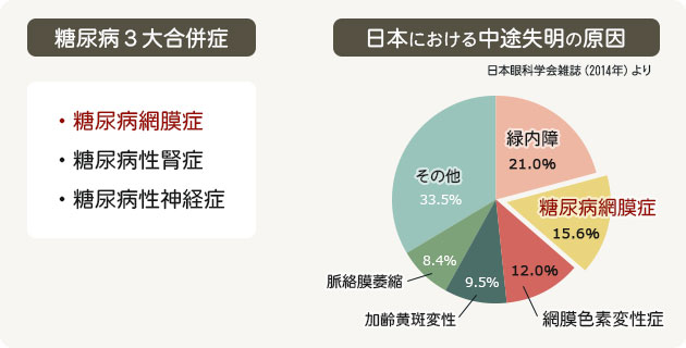 グラフ：糖尿病三大合併症、日本における中途失明の原因